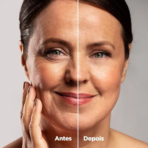 Antes e depois BlueLift