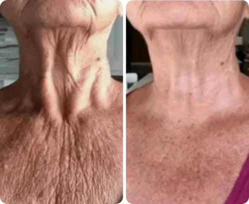 Antes e depois de Carla Burbano