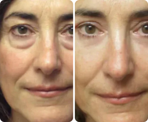 Antes e depois de Mariana Santiago