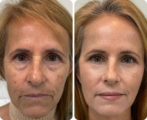 Antes e depois de Fabiola Moreira