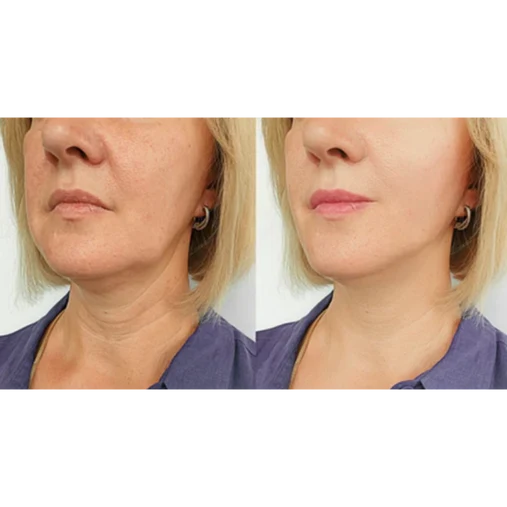 Resultado de Lucinda Fera