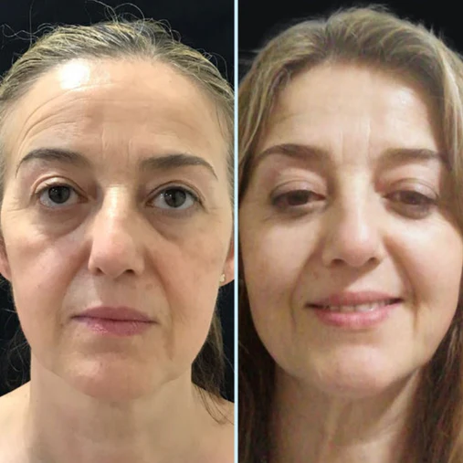 Resultado de Mônica Andrade