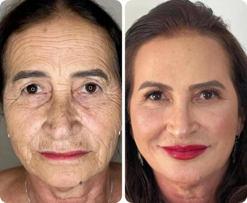 Antes e depois de Madalena Cordeiro