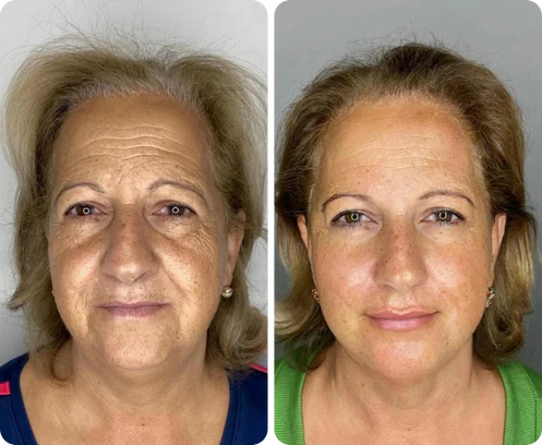 Antes e depois de Claudia Andrade