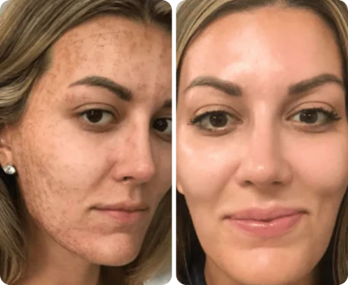 Antes e depois de Marta Lourenço